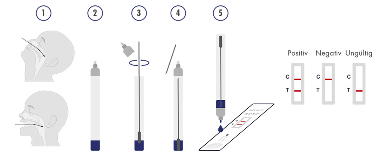 Casada Nasopharyngeal Test Anwendung