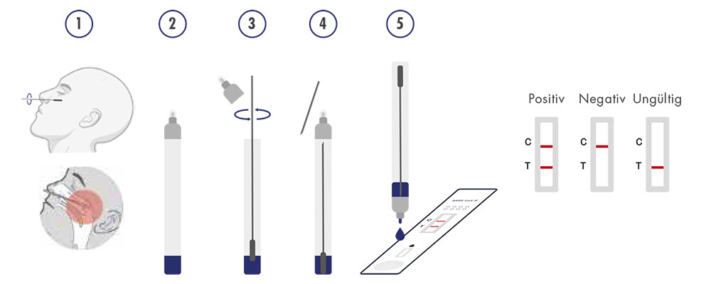 Casada Nasopharyngeal Test Anwendung
